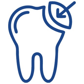 dental-bonding-1
