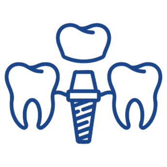 dental-implants-1