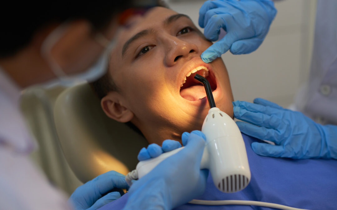 How Long Does Wisdom Teeth Removal Take From Surgery to Recovery