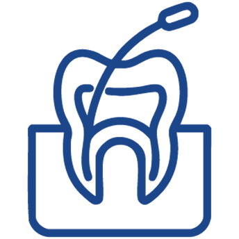 root-canal-1