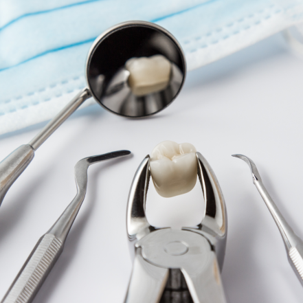 Wisdom Teeth Removal